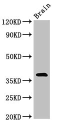 MATH2 / NEUROD6 Antibody - Western Blot Positive WB detected in: Mouse brain tissue All lanes: NEUROD6 antibody at 3µg/ml Secondary Goat polyclonal to rabbit IgG at 1/50000 dilution Predicted band size: 39 kDa Observed band size: 39 kDa
