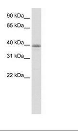 MATH2 / NEUROD6 Antibody - Transfected 293T Cell Lysate.  This image was taken for the unconjugated form of this product. Other forms have not been tested.