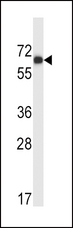 MATK Antibody - MATK Antibody (M1) western blot of HL-60 cell line lysates (35 ug/lane). The MATK antibody detected the MATK protein (arrow).