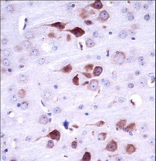 MATK Antibody - Mouse Matk Antibody immunohistochemistry of formalin-fixed and paraffin-embedded mouse brain tissue followed by peroxidase-conjugated secondary antibody and DAB staining.
