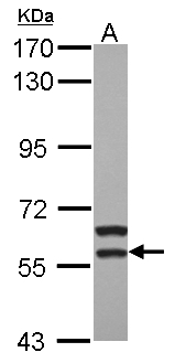 MATK Antibody - Sample (30 ug of whole cell lysate) A: HepG2 7.5% SDS PAGE MATK antibody diluted at 1:1000