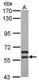 MATK Antibody - Sample (30 ug of whole cell lysate) A: HepG2 7.5% SDS PAGE MATK antibody diluted at 1:1000