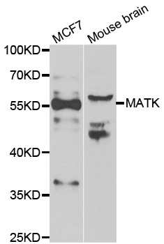 MATK Antibody - Western blot analysis of extracts of various cell lines.