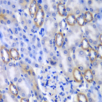 MATK Antibody - Immunohistochemistry of paraffin-embedded mouse kidney tissue.