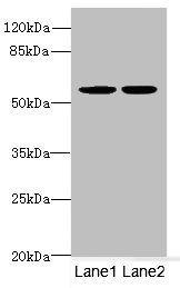 MATK Antibody - Western blot All Lanes: MATKantibody at 5.06ug/ml Lane 1 : MCF7 whole cell lysate Lane 2 : Hela whole cell lysate Secondary Goat polyclonal to Rabbit IgG at 1/10000 dilution Predicted band size: 57,52 kDa Observed band size: 56 kDa