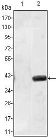 MATN1 / Matrilin 1 Antibody - MATN1 Antibody in Western Blot (WB)