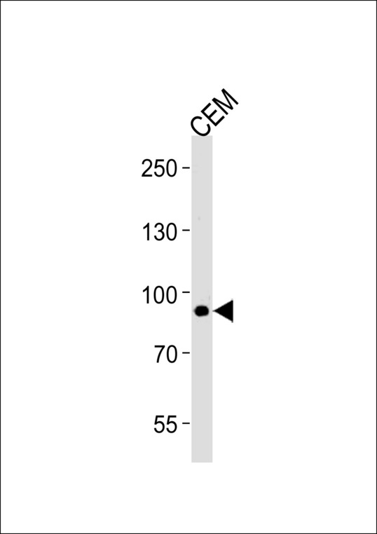 MATN2 / Matrilin 2 Antibody - MATN2 Antibody western blot of CEM cell line lysates (35 ug/lane). The MATN2 antibody detected the MATN2 protein (arrow).