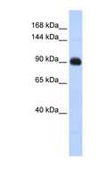 MATN2 / Matrilin 2 Antibody - MATN2 / Matrilin 2 antibody Western blot of Fetal Lung lysate. This image was taken for the unconjugated form of this product. Other forms have not been tested.