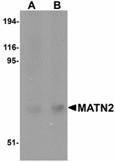 MATN2 / Matrilin 2 Antibody - Western blot of MATN2 in human liver tissue lysate with MATN2 antibody at (A) 1 and (B) 2 ug/ml.