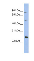 MATN3 / Matrilin 3 Antibody - MATN3 / Matrilin 3 antibody Western blot of 293T cell lysate. This image was taken for the unconjugated form of this product. Other forms have not been tested.
