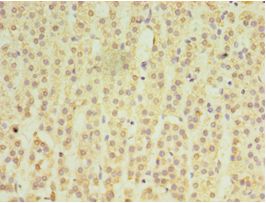 MATN3 / Matrilin 3 Antibody - Immunohistochemistry of paraffin-embedded human adrenal gland using antibody at 1:100 dilution.