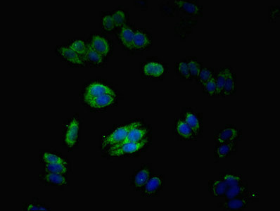 MATN3 / Matrilin 3 Antibody - Immunofluorescent analysis of HepG2 cells using MATN3 Antibody at dilution of 1:100 and Alexa Fluor 488-congugated AffiniPure Goat Anti-Rabbit IgG(H+L)