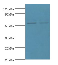 MATN3 / Matrilin 3 Antibody - Western blot. All lanes: MATN3 antibody at 14 ug/ml. Lane 1: NIH3T3 whole cell lysate. Lane 2: mouse thymus tissue. Secondary antibody: Goat polyclonal to rabbit at 1:10000 dilution. Predicted band size: 53 kDa. Observed band size: 53 kDa.