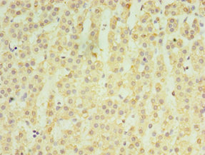 MATN3 / Matrilin 3 Antibody - Immunohistochemistry of paraffin-embedded human adrenal gland tissue using MATN3 Antibody at dilution of 1:100