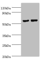 MATN3 / Matrilin 3 Antibody - Western blot All lanes: MATN3 antibody at 14µg/ml Lane 1: NIH/3T3 whole cell lysate Lane 2: Mouse thymus tissue Secondary Goat polyclonal to rabbit IgG at 1/10000 dilution Predicted band size: 53, 49 kDa Observed band size: 53 kDa