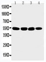 MATN3 / Matrilin 3 Antibody - WB of MATN3 / Matrilin 3 antibody. Lane 1: 293T Cell Lysate. Lane 2: COLO320 Cell Lysate. Lane 3: HELA Cell Lysate. Lane 4: A549 Cell Lysate.