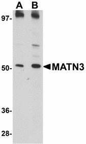 MATN3 / Matrilin 3 Antibody - Western blot of MATN3 in 3T3 cell lysate with MATN3 antibody at (A) 1 and (B) 2 ug/ml. Below: Immunocytochemistry of MATN3 in 3T3 cells with MATN3 antibody at 5 ug/ml.