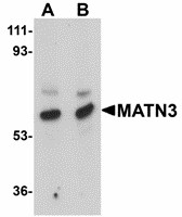 MATN3 / Matrilin 3 Antibody - Western blot of MATN3 in rat thymus tissue lysate with MATN3 antibody at (A) 1 and (B) 2 ug/ml. Below: Immunocytochemistry of MATN3 in 3T3 cells tissue with MATN3 antibody at 2.5 ug/ml.