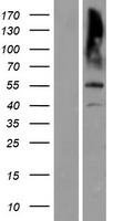 MATN3 / Matrilin 3 Protein - Western validation with an anti-DDK antibody * L: Control HEK293 lysate R: Over-expression lysate