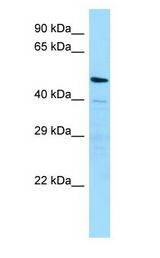 MATN4 / Matrilin 4 Antibody - MATN4 / Matrilin 4 antibody Western Blot of HepG2 cell lysate.  This image was taken for the unconjugated form of this product. Other forms have not been tested.