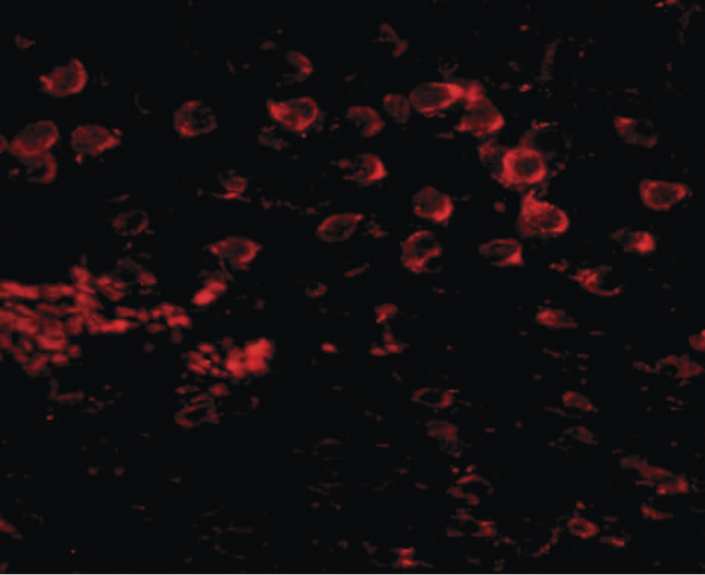 MATN4 / Matrilin 4 Antibody - Immunofluorescence of MATN4 in mouse brain tissue with MATN4 antibody at 20 ug/ml.