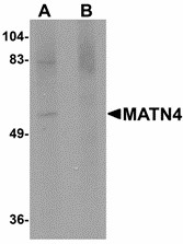 MATN4 / Matrilin 4 Antibody - Western blot of MATN4 in rat brain tissue lysate with MATN4 antibody at 1 ug/ml in (A) the absence and (B) the presence of blocking peptide. Below: Immunohistochemistry of MATN4 in mouse brain tissue with MATN4 antibody at 2.5 ug/ml.