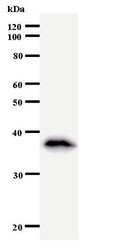MATR3 / Matrin 3 Antibody - Western blot of immunized recombinant protein using MATR3 antibody.