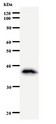 MATR3 / Matrin 3 Antibody - Western blot of immunized recombinant protein using MATR3 antibody.