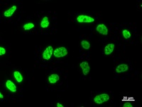 MATR3 / Matrin 3 Antibody - Immunostaining analysis in HeLa cells. HeLa cells were fixed with 4% paraformaldehyde and permeabilized with 0.1% Triton X-100 in PBS. The cells were immunostained with anti-MATR3 mAb.