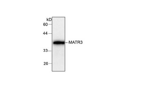 MATR3 / Matrin 3 Antibody