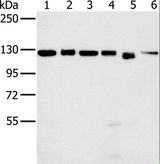 MATR3 / Matrin 3 Antibody - Western blot analysis of 293T, K562, HeLa, 231, Jurkat and NIH/3T3 cell, using MATR3 Polyclonal Antibody at dilution of 1:500.