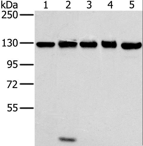 MATR3 / Matrin 3 Antibody - Western blot analysis of NIH/3T3, 231, HeLa, K562 and 293T cell, using MATR3 Polyclonal Antibody at dilution of 1:400.