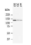 MATR3 / Matrin 3 Antibody - Detection of MATR3 by Western blot. Samples: Whole cell lysate from human HT-1080 (H, 25 ug), mouse NIH3T3 (M, 25 ug) and rat F2408 (R, 25 ug) cells. Predicted molecular weight: 94 kD.