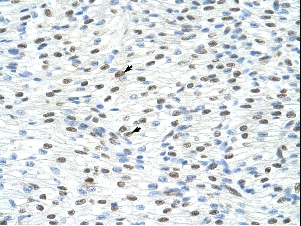 MATR3 / Matrin 3 Antibody - MATR3 / Matrin 3 antibody ARP40922_T100-NP_061322-MATR3 (matrin 3) Antibody was used in IHC to stain formalin-fixed, paraffin-embedded human heart.  This image was taken for the unconjugated form of this product. Other forms have not been tested.