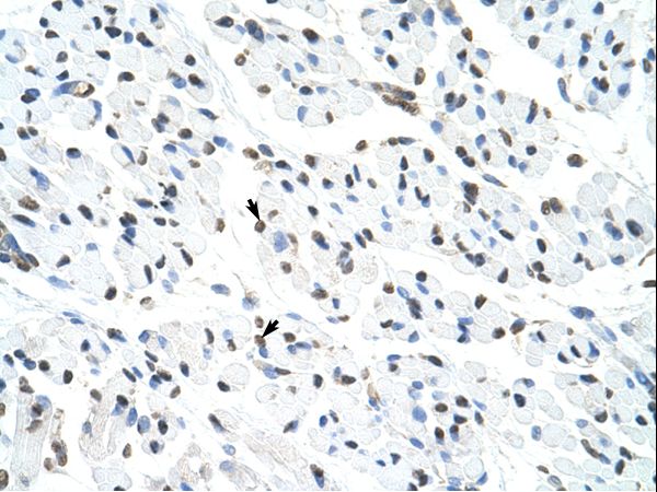 MATR3 / Matrin 3 Antibody - MATR3 / Matrin 3 antibody ARP40922_T100-NP_061322-MATR3 (matrin 3) Antibody was used in IHC to stain formalin-fixed, paraffin-embedded human muscle.  This image was taken for the unconjugated form of this product. Other forms have not been tested.