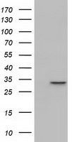 MAWDBP / PBLD Antibody - HEK293T cells were transfected with the pCMV6-ENTRY control (Left lane) or pCMV6-ENTRY PBLD (Right lane) cDNA for 48 hrs and lysed. Equivalent amounts of cell lysates (5 ug per lane) were separated by SDS-PAGE and immunoblotted with anti-PBLD.
