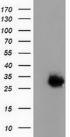 MAWDBP / PBLD Antibody - HEK293T cells were transfected with the pCMV6-ENTRY control (Left lane) or pCMV6-ENTRY PBLD (Right lane) cDNA for 48 hrs and lysed. Equivalent amounts of cell lysates (5 ug per lane) were separated by SDS-PAGE and immunoblotted with anti-PBLD.