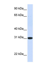 MAWDBP / PBLD Antibody - PBLD antibody Western blot of Fetal Liver lysate. This image was taken for the unconjugated form of this product. Other forms have not been tested.