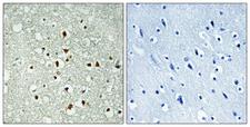 MAX Antibody - Immunohistochemistry analysis of paraffin-embedded human brain tissue, using MAX Antibody. The picture on the right is blocked with the synthesized peptide.