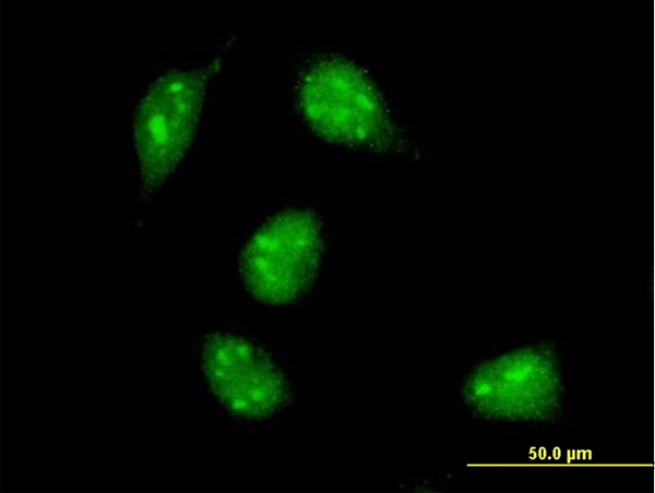 MAX Antibody - Immunofluorescence of monoclonal antibody to MAX on HeLa cell . [antibody concentration 10 ug/ml]