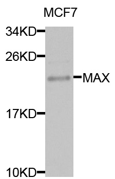 MAX Antibody - Western blot analysis of extracts of MCF7 cells.