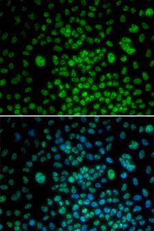 MAX Antibody - Immunofluorescence analysis of U20S cells.