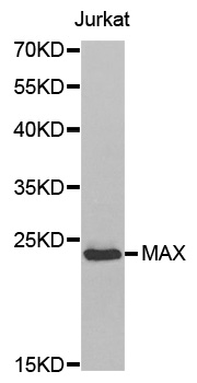MAX Antibody - Western blot blot of extracts of Jurkat cell line, using MAX antibody.
