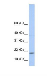 MAX Antibody - Fetal lung lysate. Antibody concentration: 1.0 ug/ml. Gel concentration: 10-20%.  This image was taken for the unconjugated form of this product. Other forms have not been tested.