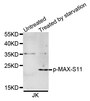MAX Antibody - Western blot analysis of extracts of Jurkat cells.