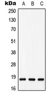 MAX Antibody - Western blot analysis of MAX (pS11) expression in HeLa (A); mouse heart (B); H9C2 (C) whole cell lysates.