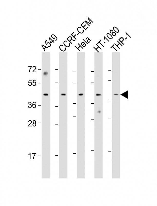 MAZ Antibody - All lanes: Anti-MAZ Antibody (Center) at 1:1000 dilution. Lane 1: A549 whole cell lysate. Lane 2: CCRF-CEM whole cell lysate. Lane 3: HeLa whole cell lysate. Lane 4: HT-1080 whole cell lysate. Lane 5: THP-1 whole cell lysate Lysates/proteins at 20 ug per lane. Secondary Goat Anti-Rabbit IgG, (H+L), Peroxidase conjugated at 1:10000 dilution. Predicted band size: 49 kDa. Blocking/Dilution buffer: 5% NFDM/TBST.