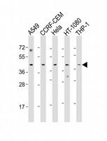 MAZ Antibody - All lanes: Anti-MAZ Antibody (Center) at 1:1000 dilution. Lane 1: A549 whole cell lysate. Lane 2: CCRF-CEM whole cell lysate. Lane 3: HeLa whole cell lysate. Lane 4: HT-1080 whole cell lysate. Lane 5: THP-1 whole cell lysate Lysates/proteins at 20 ug per lane. Secondary Goat Anti-Rabbit IgG, (H+L), Peroxidase conjugated at 1:10000 dilution. Predicted band size: 49 kDa. Blocking/Dilution buffer: 5% NFDM/TBST.