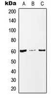 MAZ Antibody - Western blot analysis of MAZ expression in MCF7 (A); Raw264.7 (B); PC12 (C) whole cell lysates.