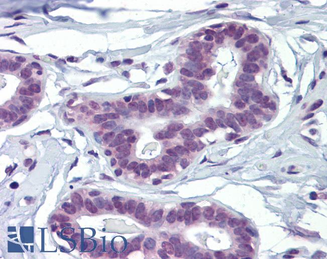 MAZ Antibody - Anti-MAZ antibody IHC of human breast. Immunohistochemistry of formalin-fixed, paraffin-embedded tissue after heat-induced antigen retrieval. Antibody concentration 10 ug/ml.  This image was taken for the unconjugated form of this product. Other forms have not been tested.